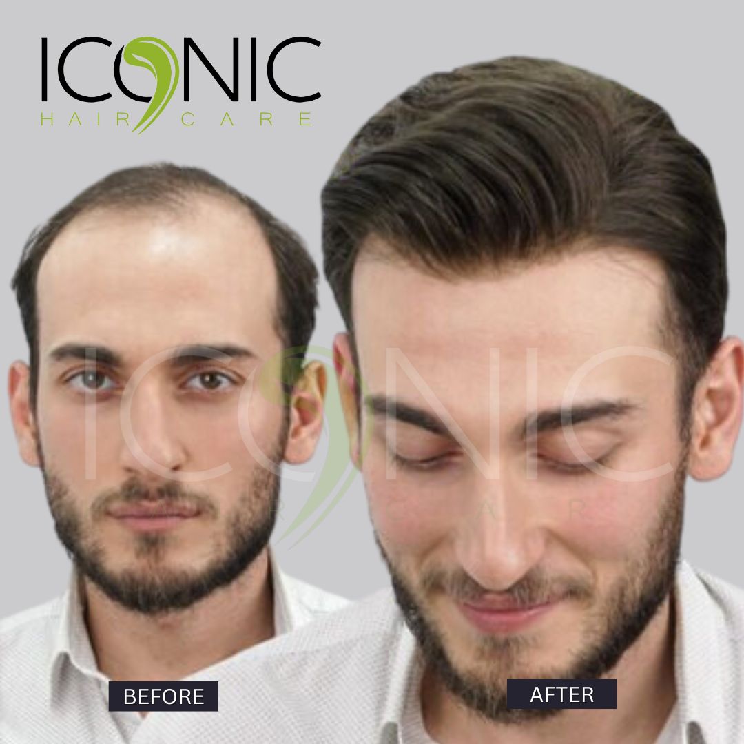 نتيجة قبل وبعد من ICONIC Hair Care 1
