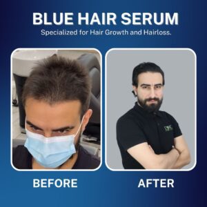blue hair serum (1)