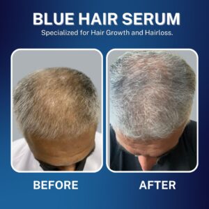 blue hair serum (2)
