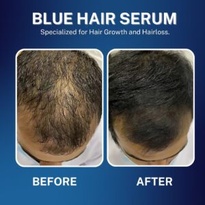 blue hair serum (3)
