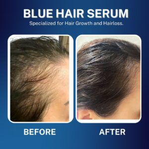 blue hair serum