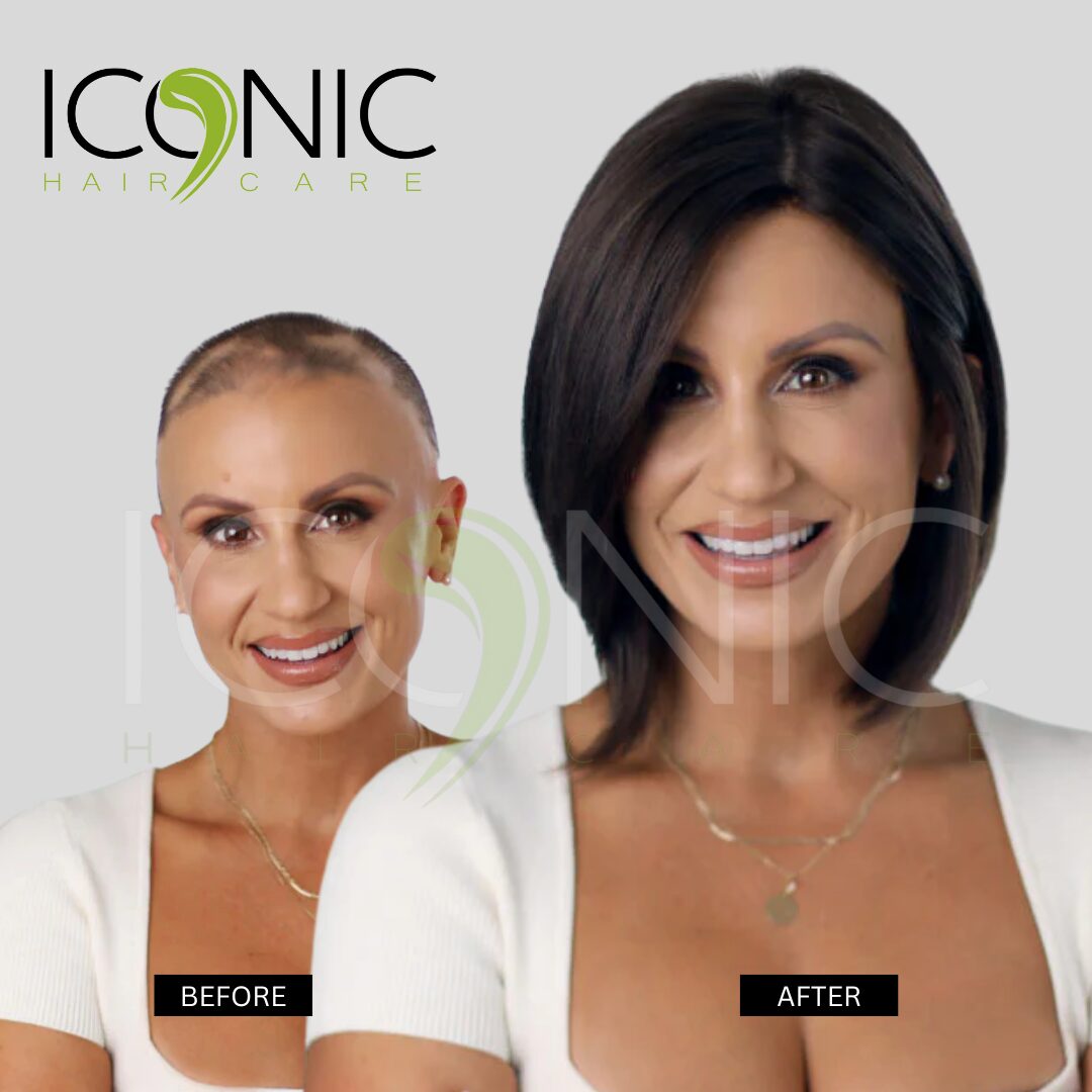 نتيجة قبل وبعد من ICONIC Hair Care 10