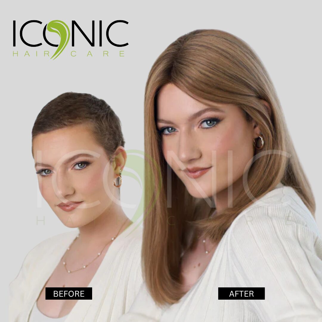 نتيجة قبل وبعد من ICONIC Hair Care 9